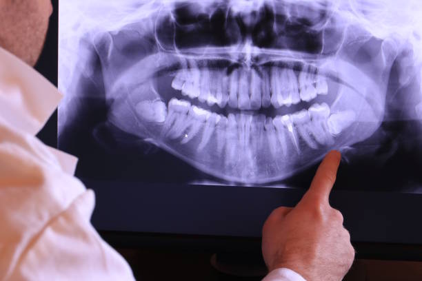 Best Emergency TMJ Treatment in Riner, VA