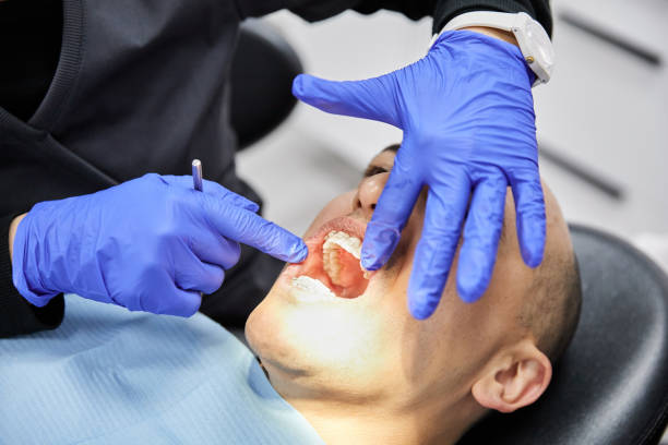 Best Emergency Treatment for Dental Infections or Abscesses in Riner, VA