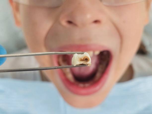 Best Weekend Emergency Dentist in Riner, VA