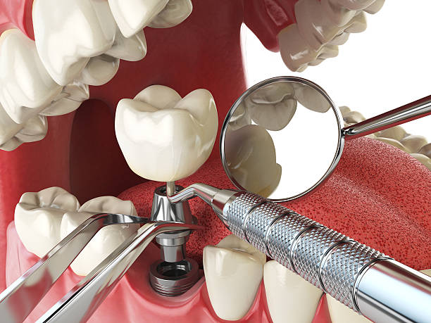 Best Emergency Denture Repair in Riner, VA