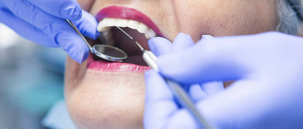 Best Emergency Tooth Extraction in Riner, VA